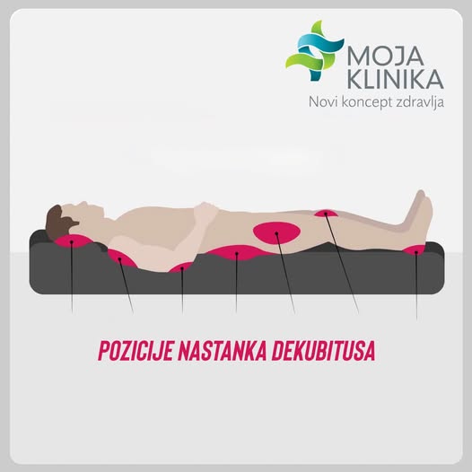 Moja klinika Hospis sa savršenom kontrolom nastanka dekubitusa